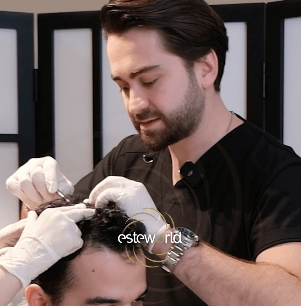 BIO FUE Hair Transplant in Turkey