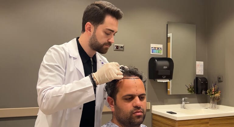 Przeszczep włosów za granicą