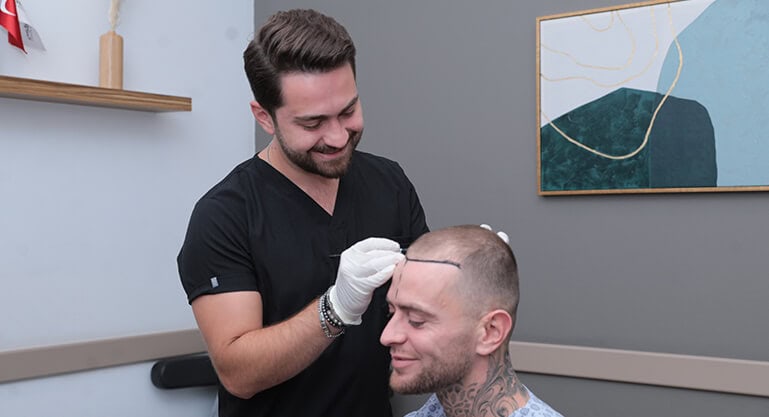 Przeszczep włosów za granicą