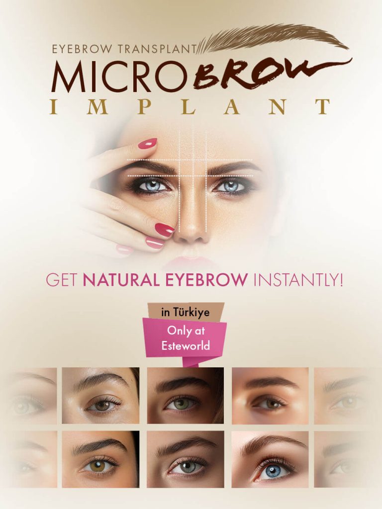 Micro Brow Implant Eyebrow Transplant