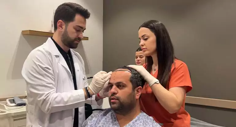before hair transplant in turkey