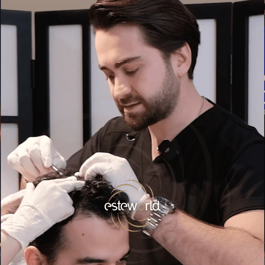esteworld hair transplant