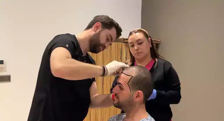 hair transplant in turkey hairline design