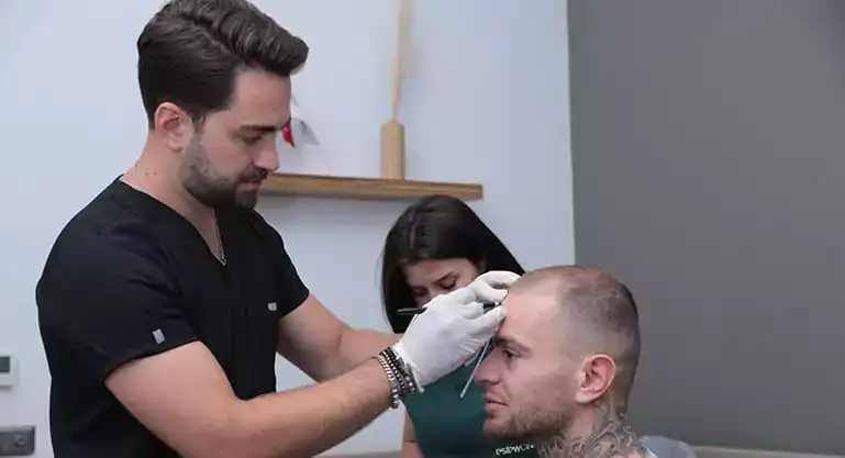 Hair Transplant in Turkey