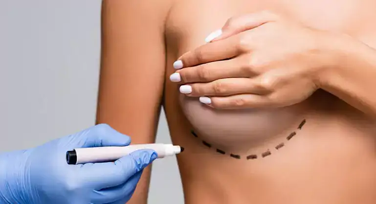 Breast Surgery in Turkey