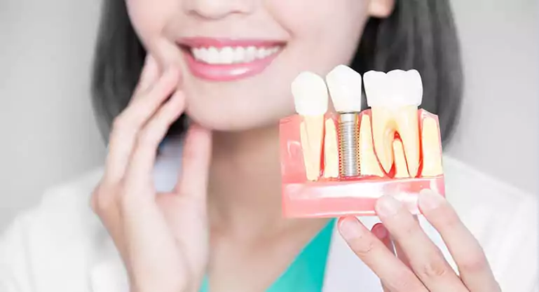 dental implant in turkey