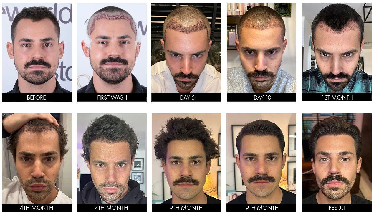 hair before after13