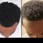 afro before afte