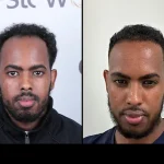 afro before after0