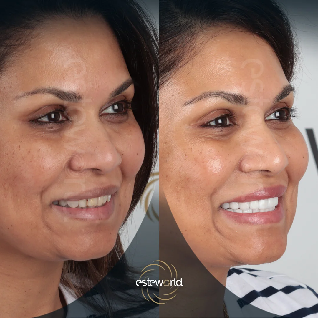 dental-before-after1