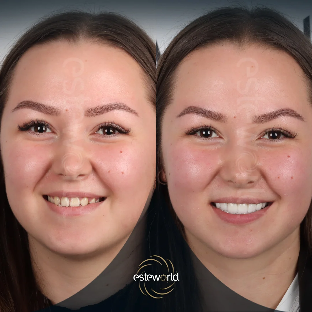 dental-before-after10