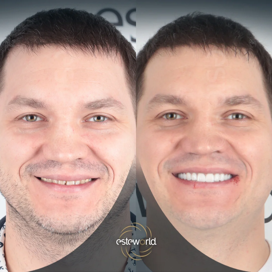 dental-before-after11