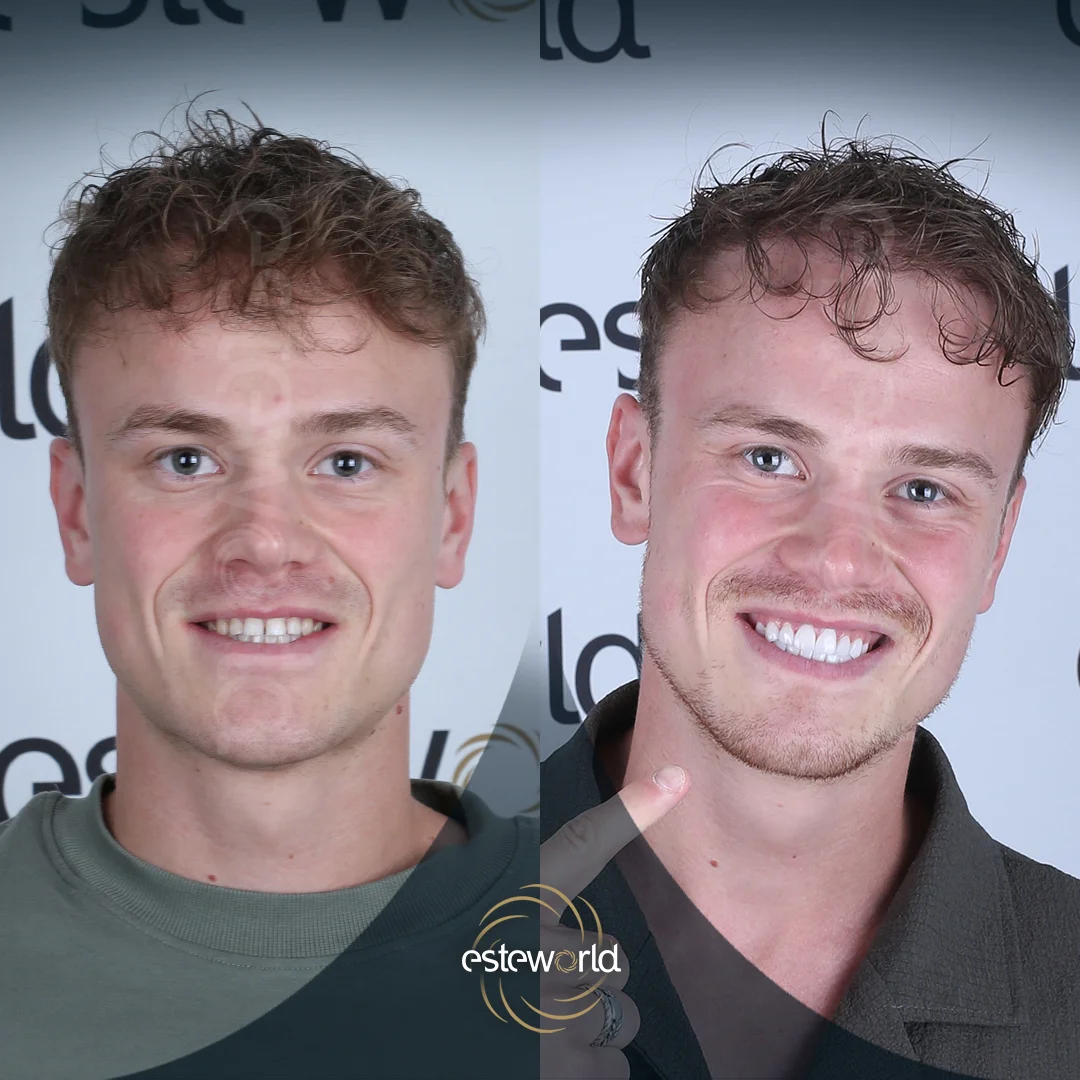 dental-before-after12