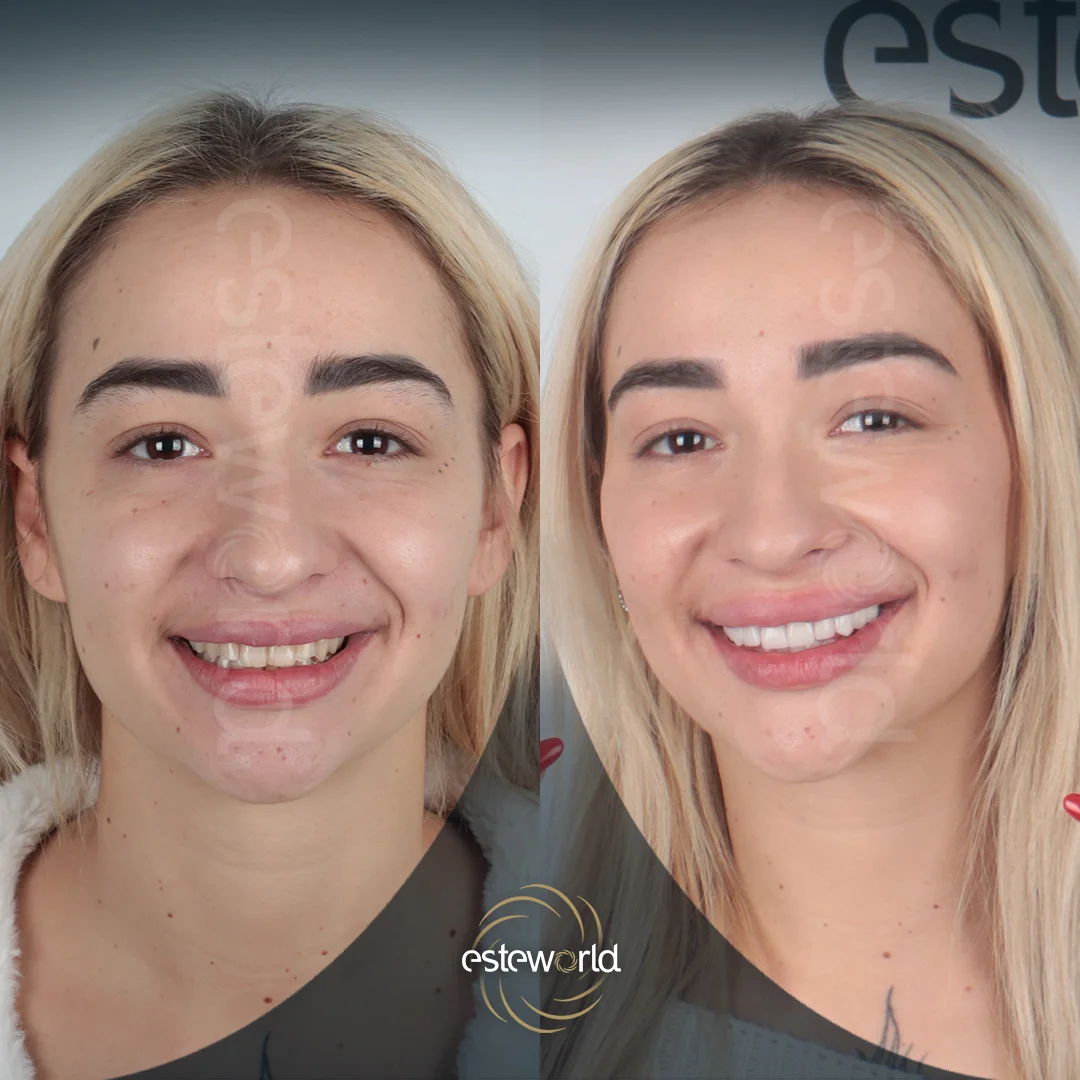 dental-before-after14