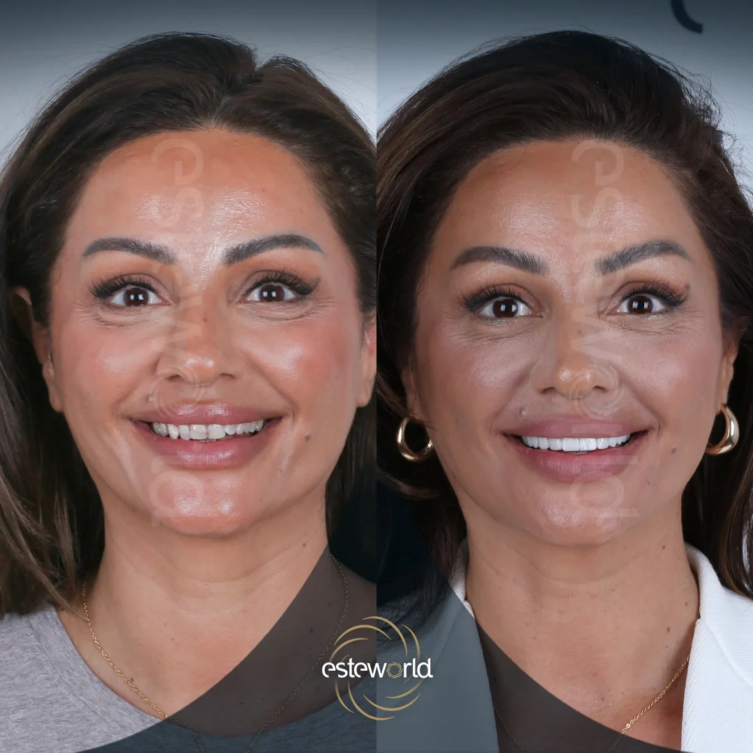 dental-before-after15