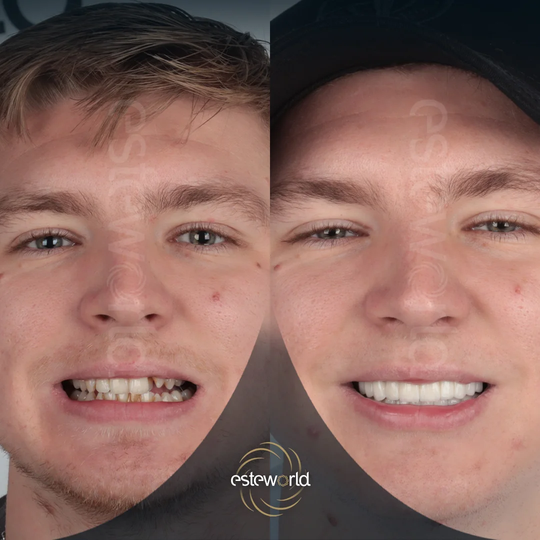 dental-before-after2