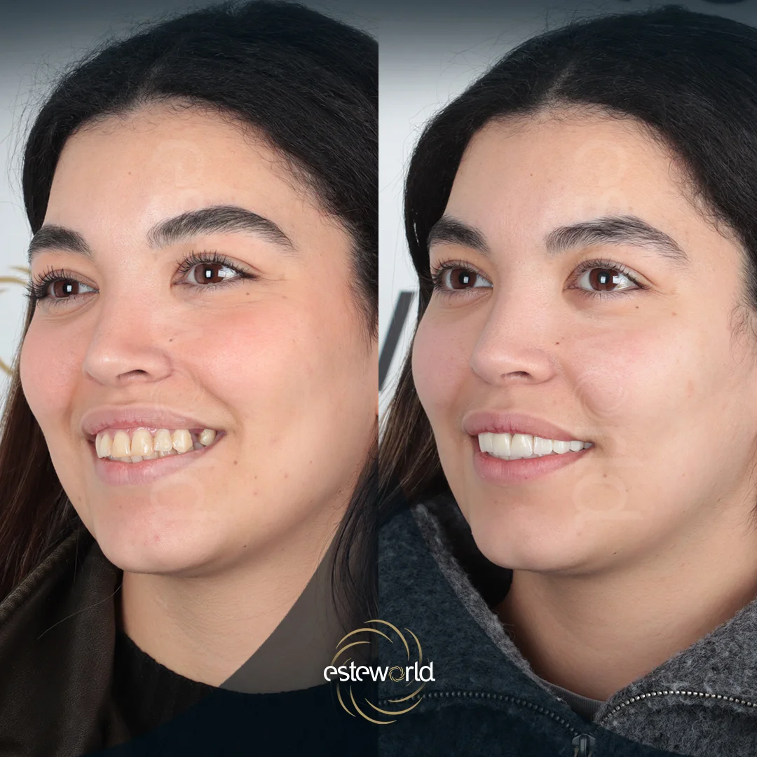 dental-before-after5