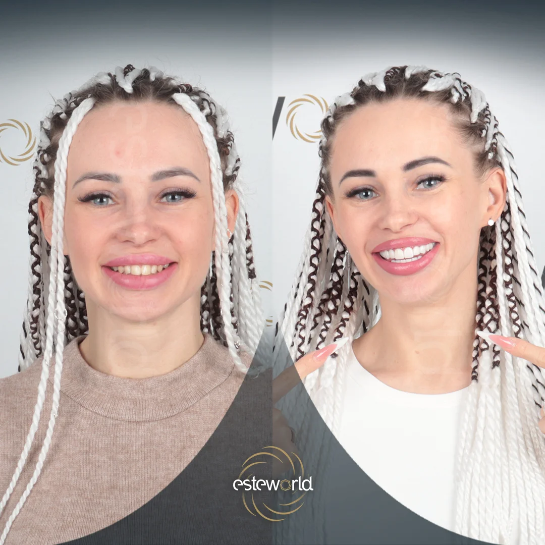 dental-before-after7