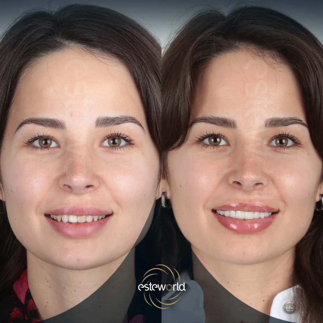 dental-before-after9