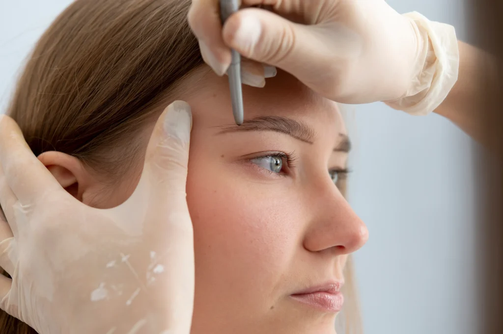 Hair Transplant