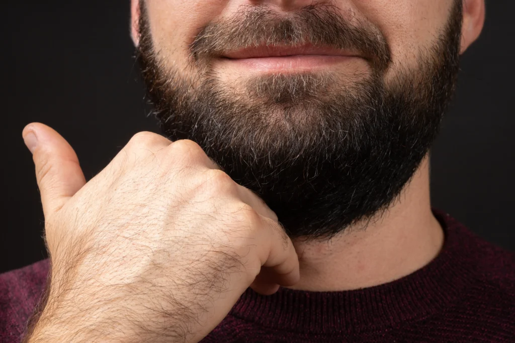 Hair Transplant