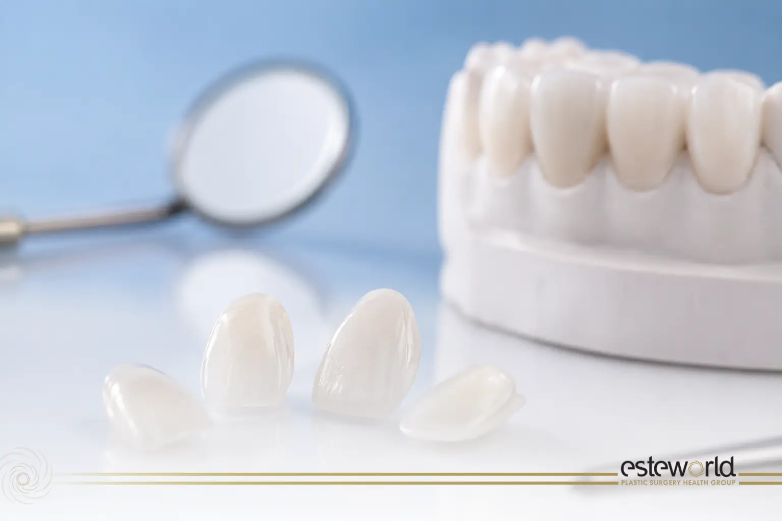 cosa sono le faccette dentali_