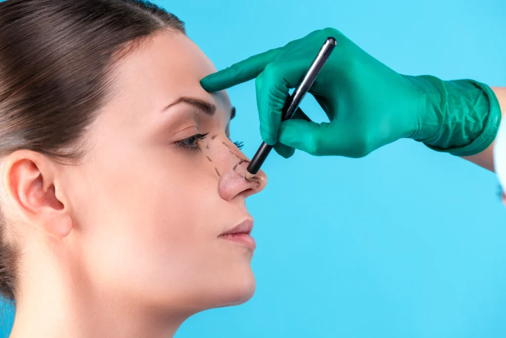 Septorhinoplasty